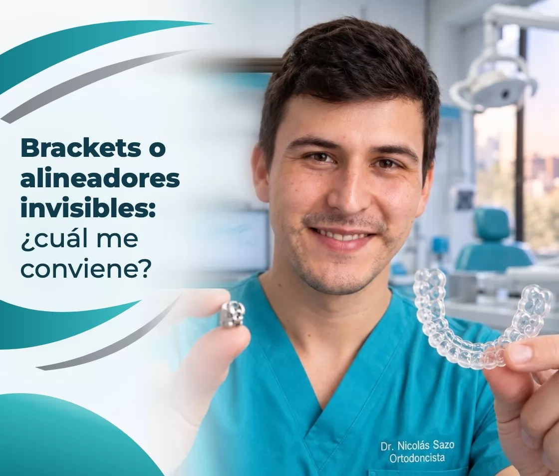 Brackets o alineadores invisibles: ¿cuál me conviene?
