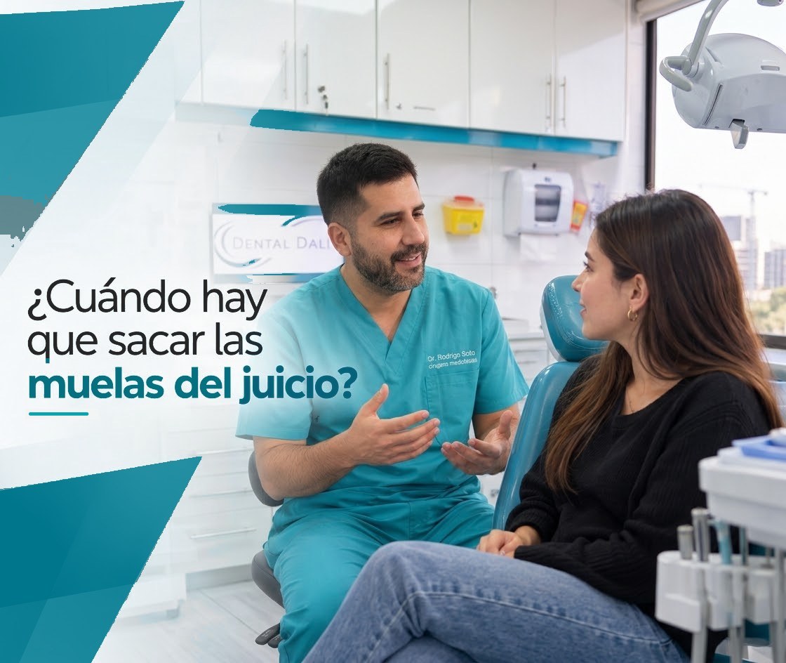 ¿Cuándo hay que sacar las muelas del juicio?