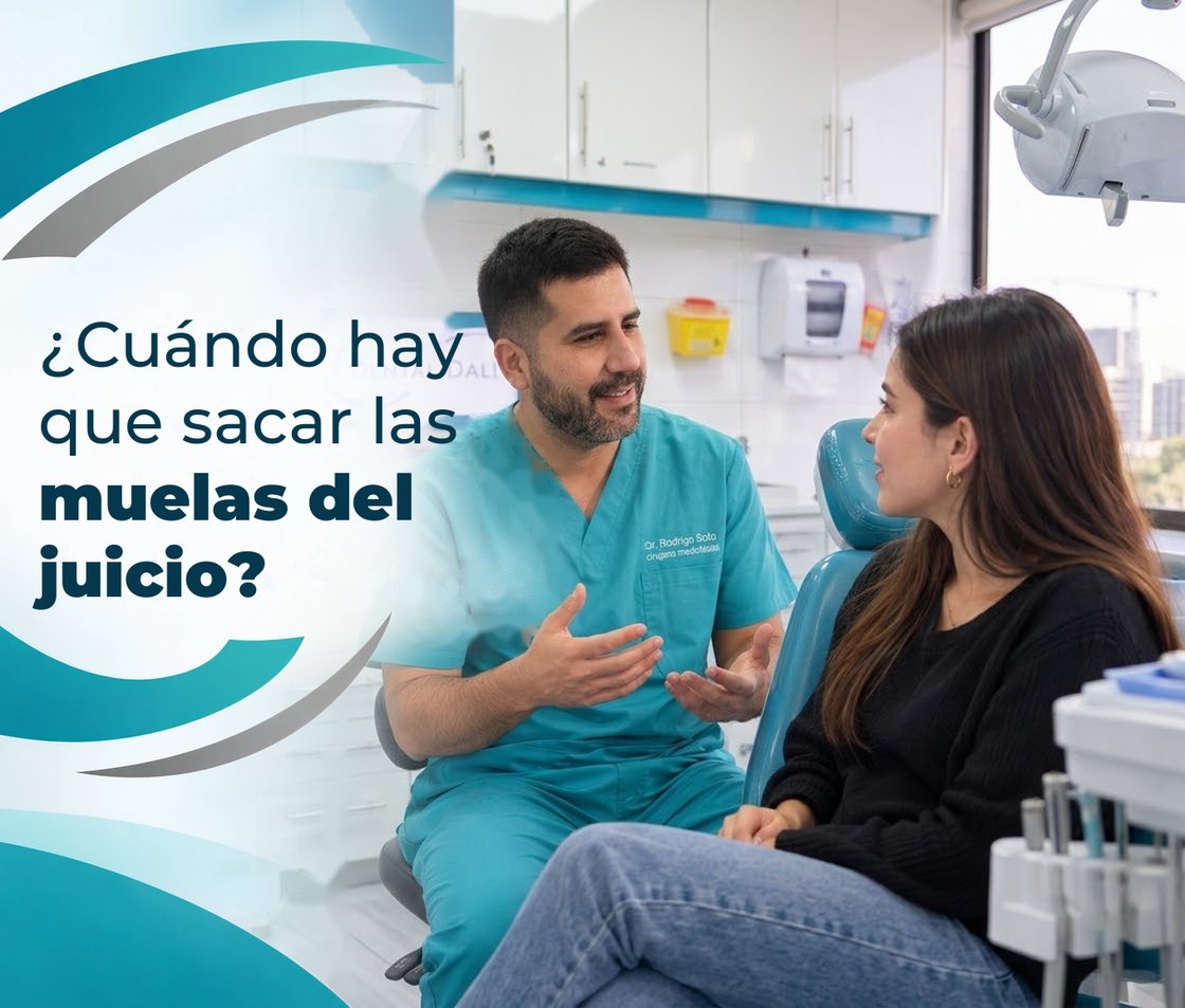 ¿Cuándo hay que sacar las muelas del juicio?