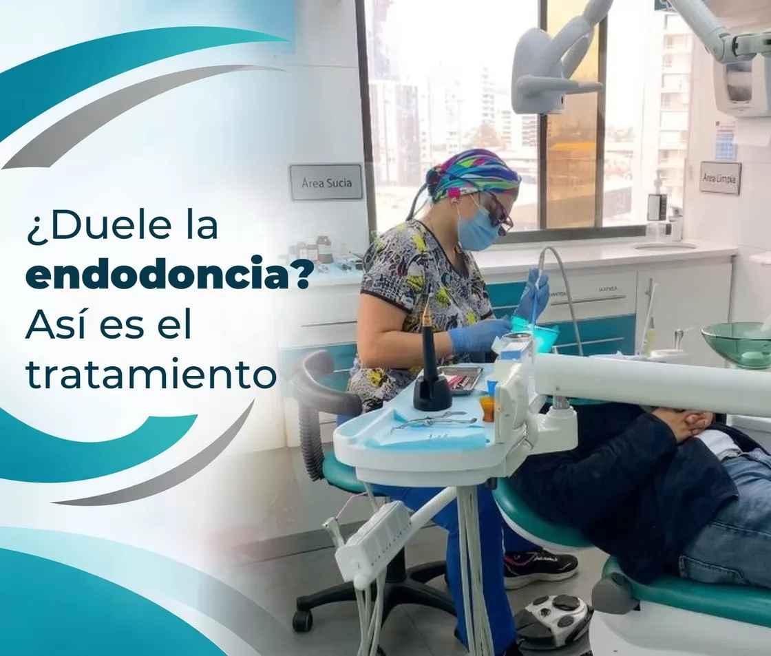 ¿Duele la endodoncia? Cómo es el tratamiento de conducto paso a paso