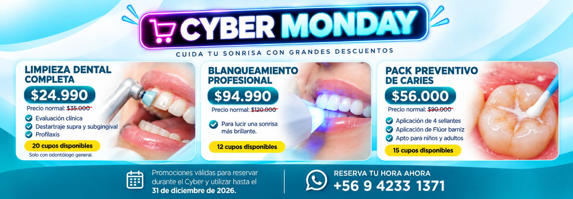 Promociones Clínica Dental Dalí La Florida
