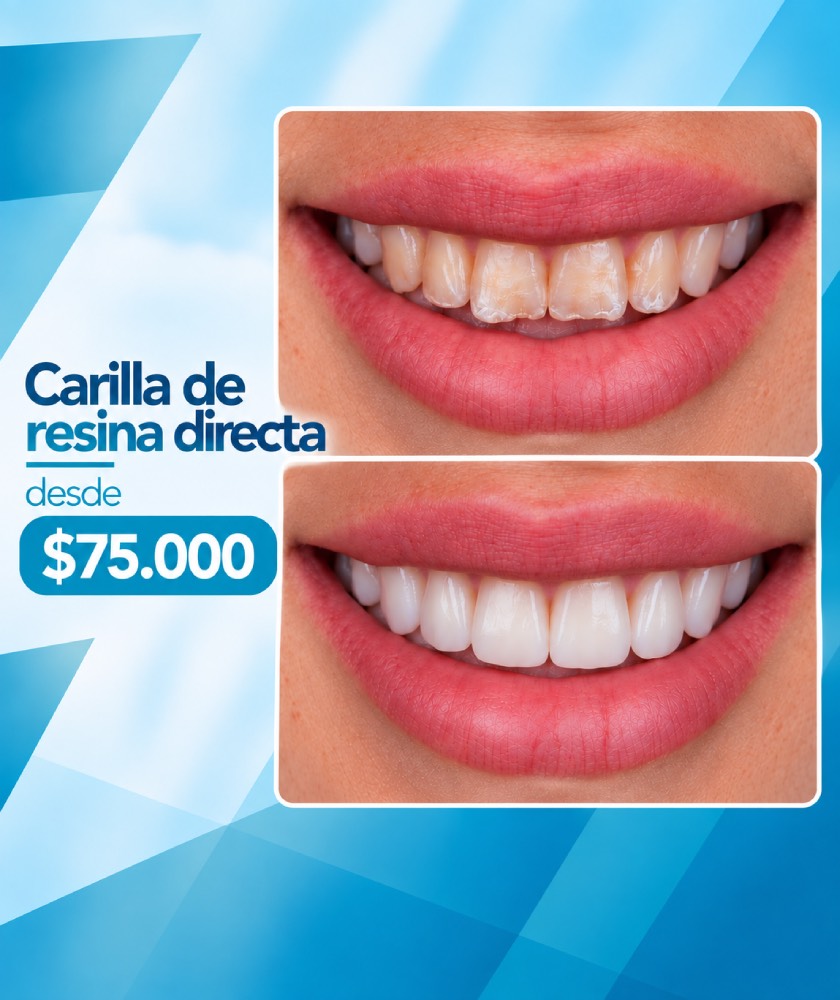 Promociones Clínica Dental Dalí La Florida