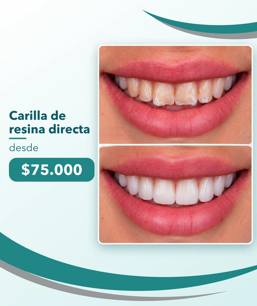 Promociones Clínica Dental Dalí La Florida