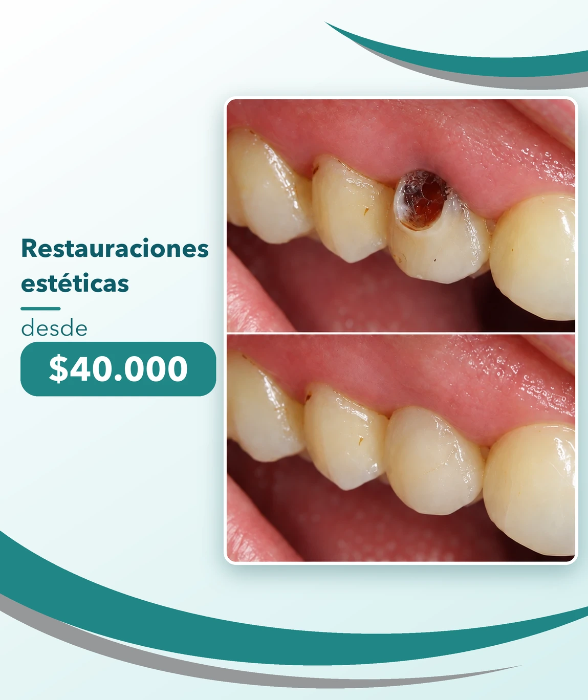 Promociones Clínica Dental Dalí La Florida