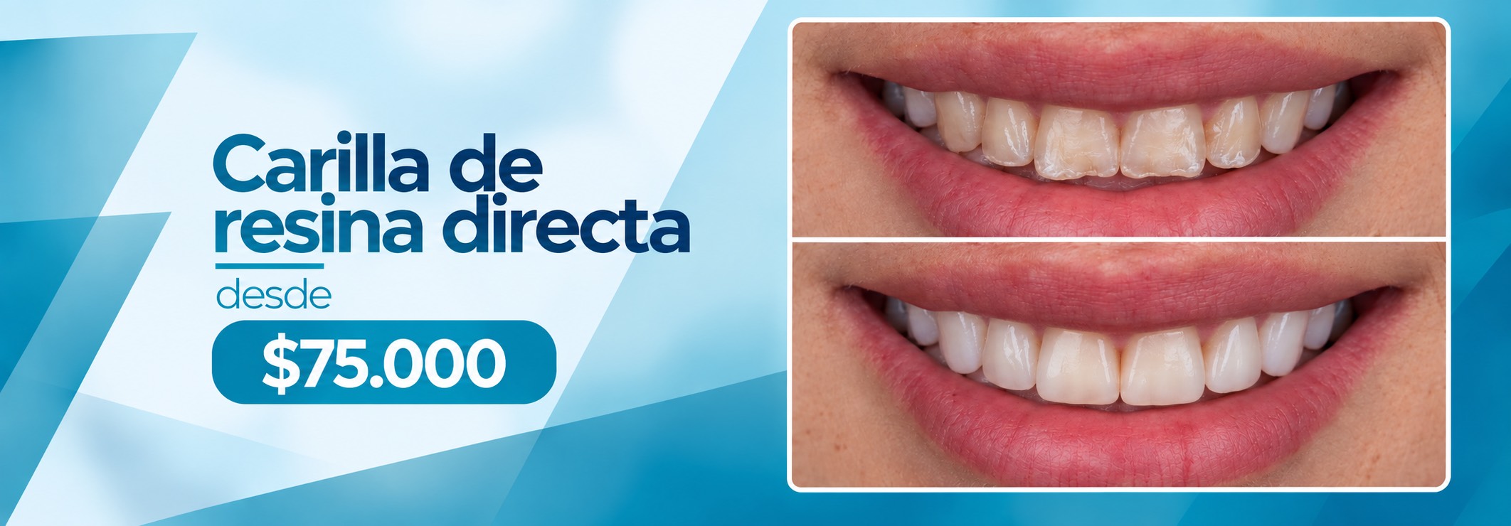 Promociones Clínica Dental Dalí La Florida