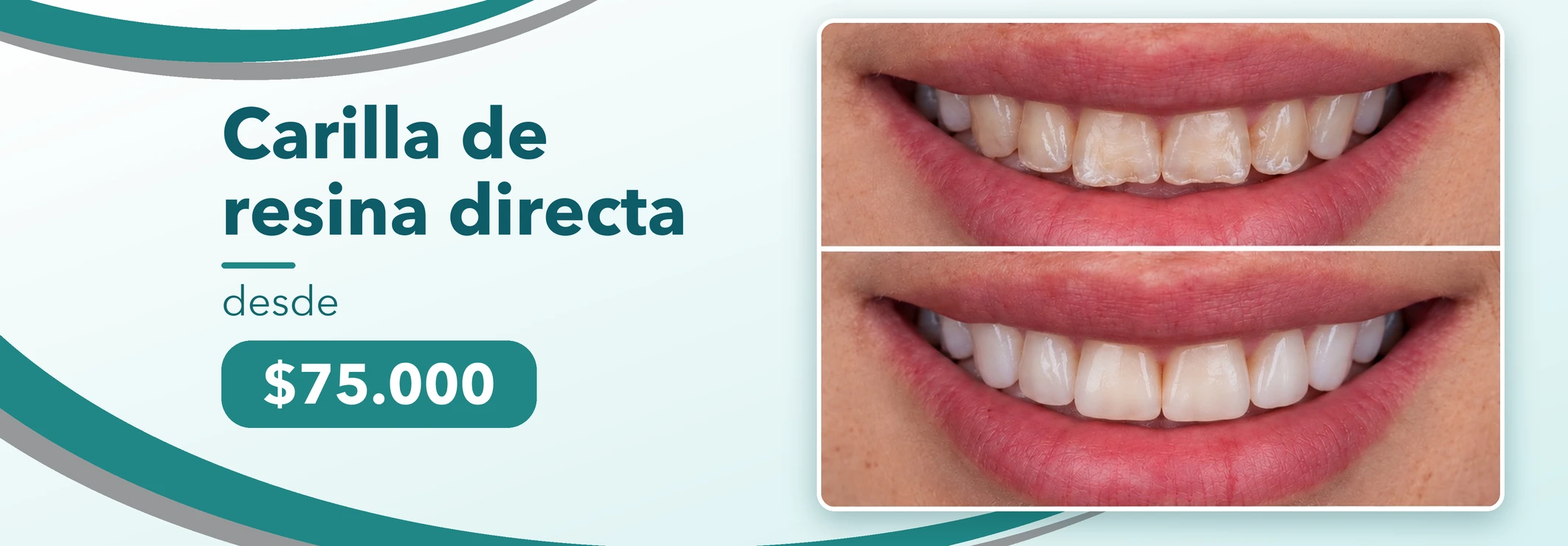 Promociones Clínica Dental Dalí La Florida