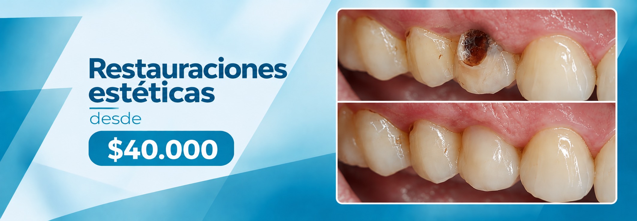 Promociones Clínica Dental Dalí La Florida