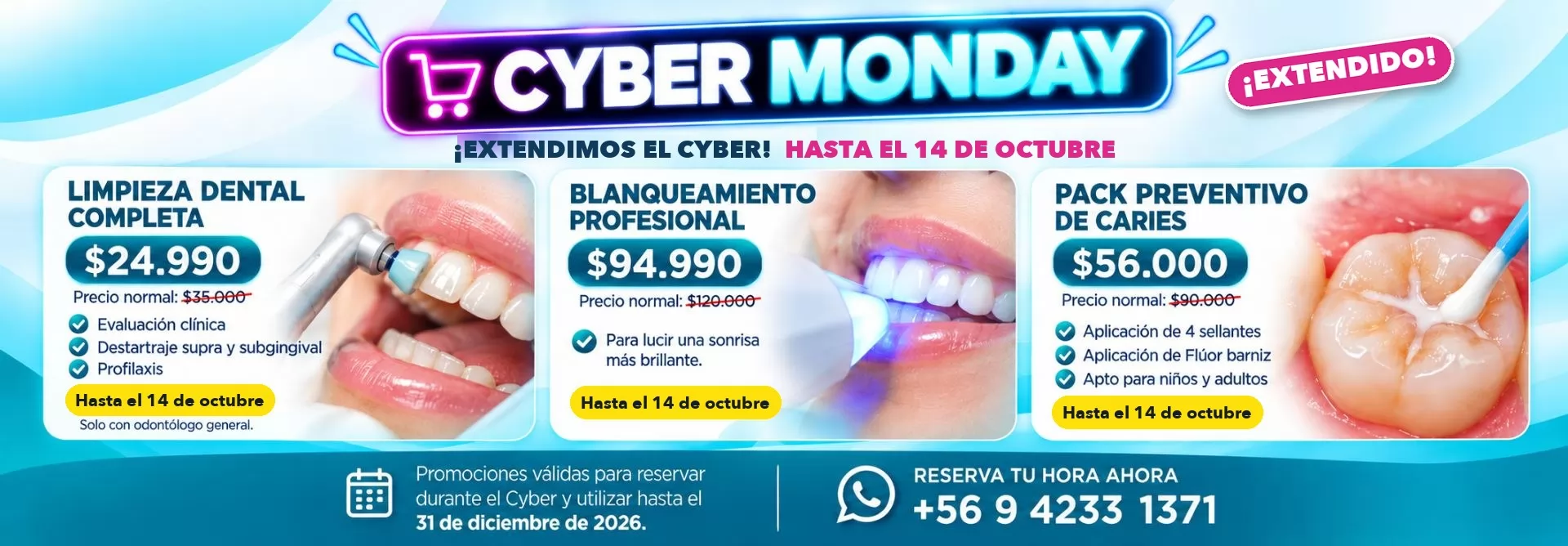 Promociones Clínica Dental Dalí La Florida