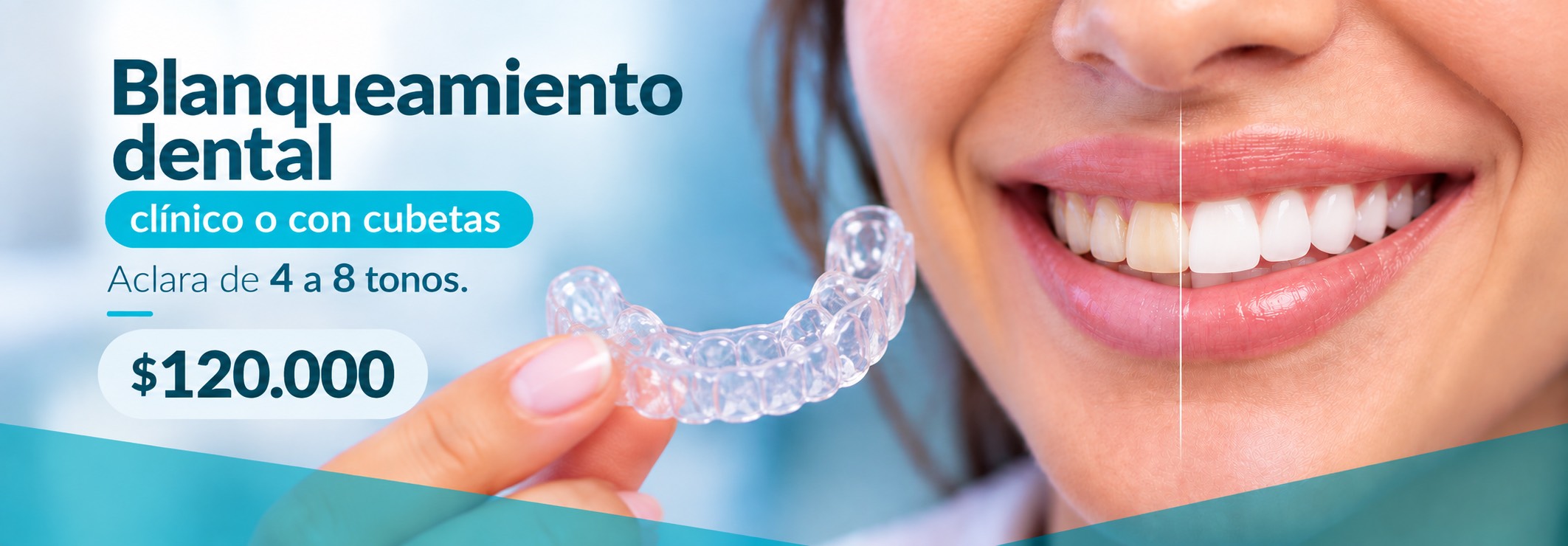 Promociones Clínica Dental Dalí La Florida