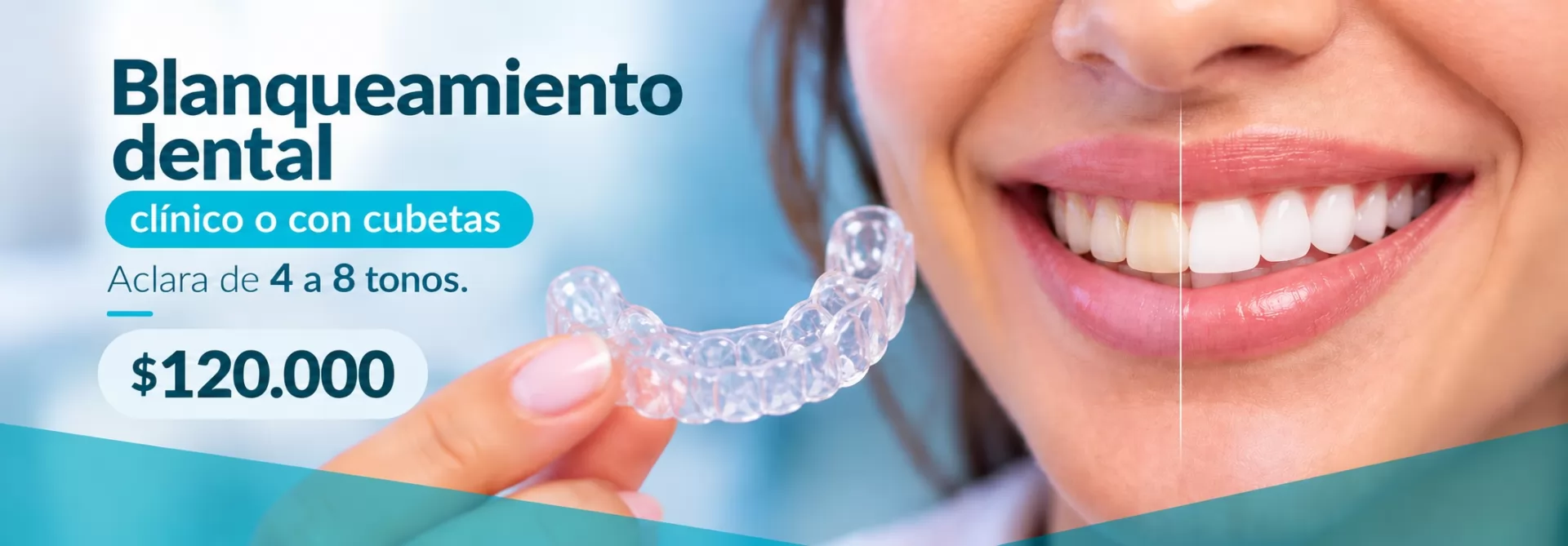 Promociones Clínica Dental Dalí La Florida