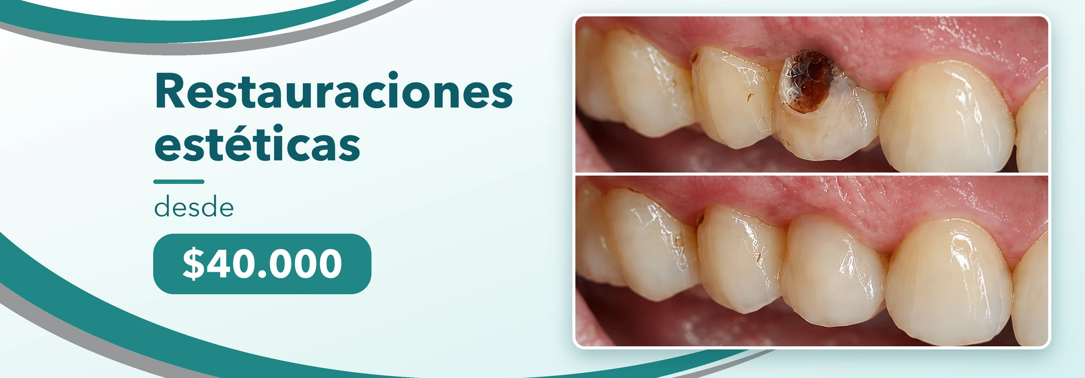 Promociones Clínica Dental Dalí La Florida