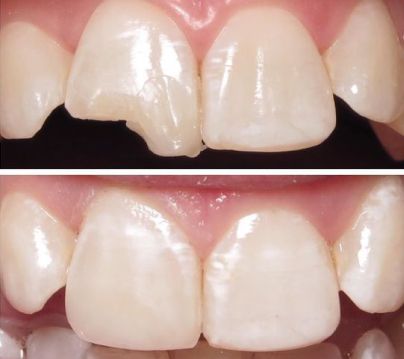 Odontología General y Estética Dental en Clínica Dental Dalí, La Florida