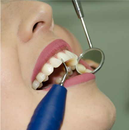 Periodoncia (Tratamiento y Cuidado de Encías) en Clínica Dental Dalí, La Florida